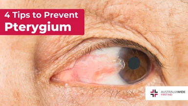 Prevent pterygium article header – First Aid Article in Dapto